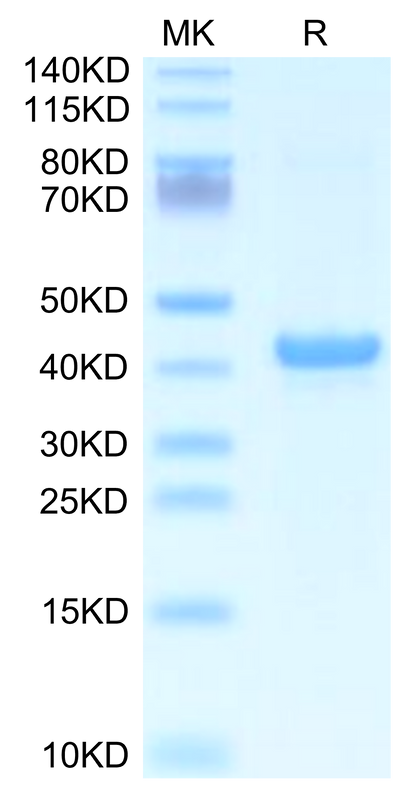 Mouse APOA5 on Tris-Bis PAGE under reduced condition. The purity is greater than 95%.Recombinant Mouse APOA5 Protein