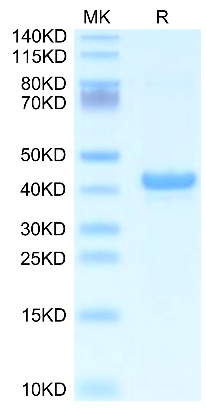 Mouse APOA5 on Tris-Bis PAGE under reduced condition. The purity is greater than 95%.Recombinant Mouse APOA5 Protein