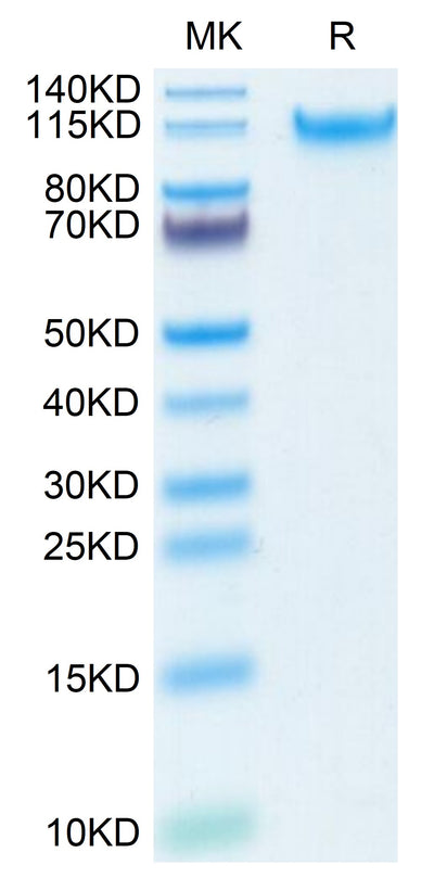 Human MANSC1 on Tris-Bis PAGE under reduced condition. The purity is greater than 95%.Recombinant Human MANSC1 Protein, Active