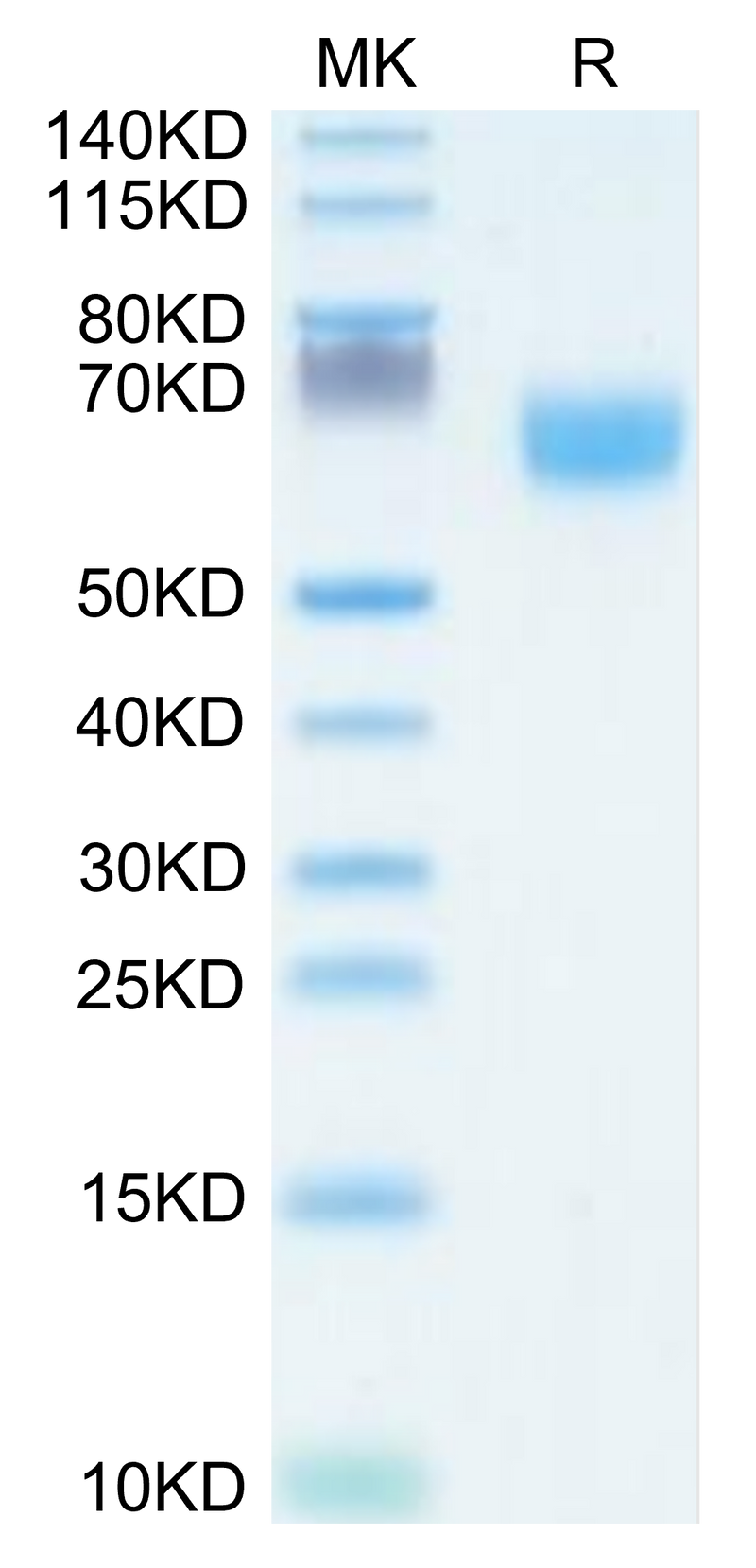 Human FGFR2 beta (IIIb) Domain on Tris-Bis PAGE under reduced condition. The purity is greater than 95%.Recombinant Human FGFR2 beta (IIIb) Domain Protein, Active