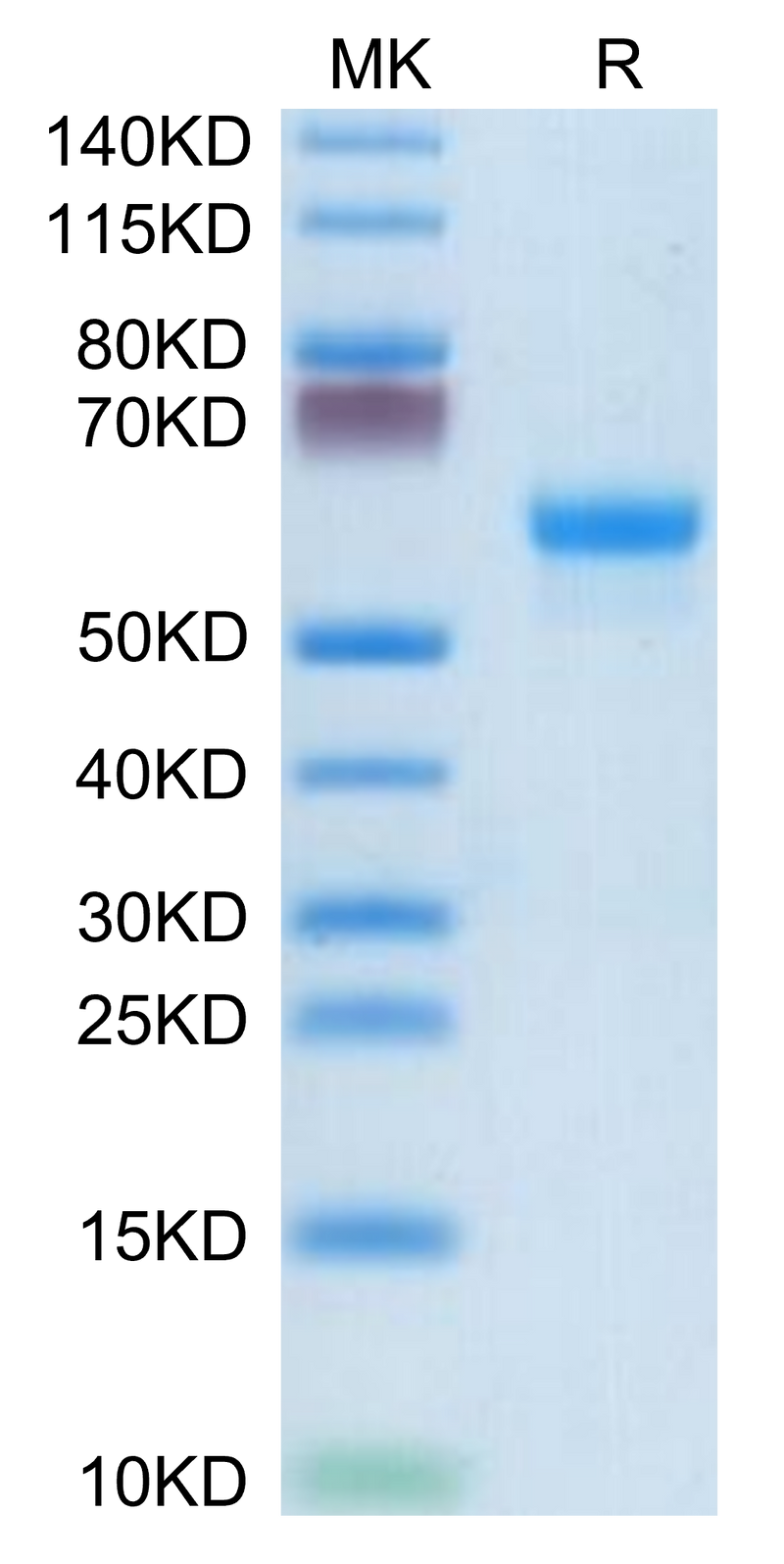 Mouse CLEC4A/DCIR on Tris-Bis PAGE under reduced condition. The purity is greater than 95%.Recombinant Mouse CLEC4A/DCIR Protein