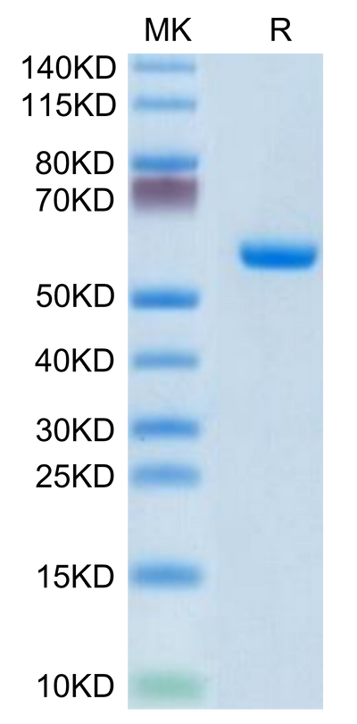 Human CLEC4A on Tris-Bis PAGE under reduced condition. The purity is greater than 95%.Recombinant Human CLEC4A/DCIR Protein, Active
