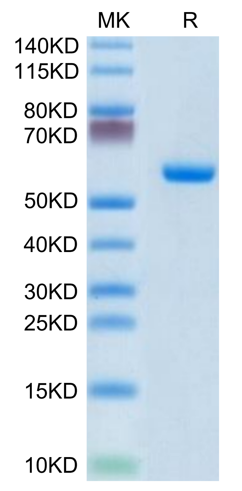 Human CLEC4A on Tris-Bis PAGE under reduced condition. The purity is greater than 95%.Recombinant Human CLEC4A/DCIR Protein, Active