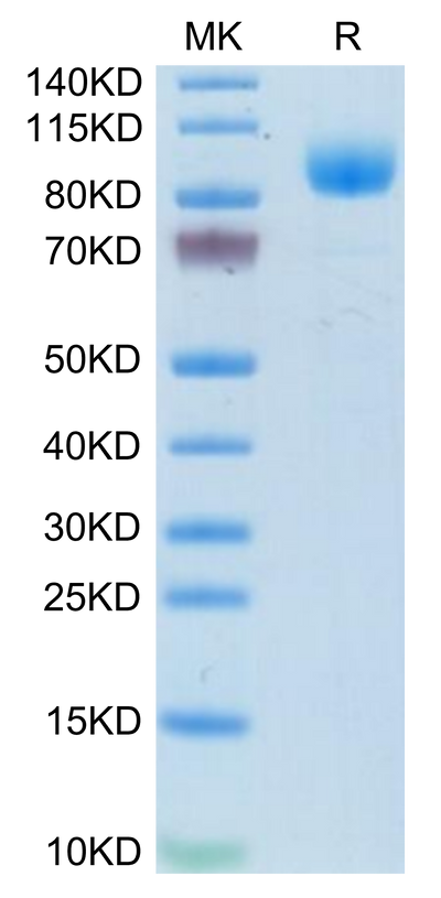 Mouse IFNAR1 on Tris-Bis PAGE under reduced condition. The purity is greater than 95%.Recombinant Mouse IFN alpha/beta R1 Protein, Active