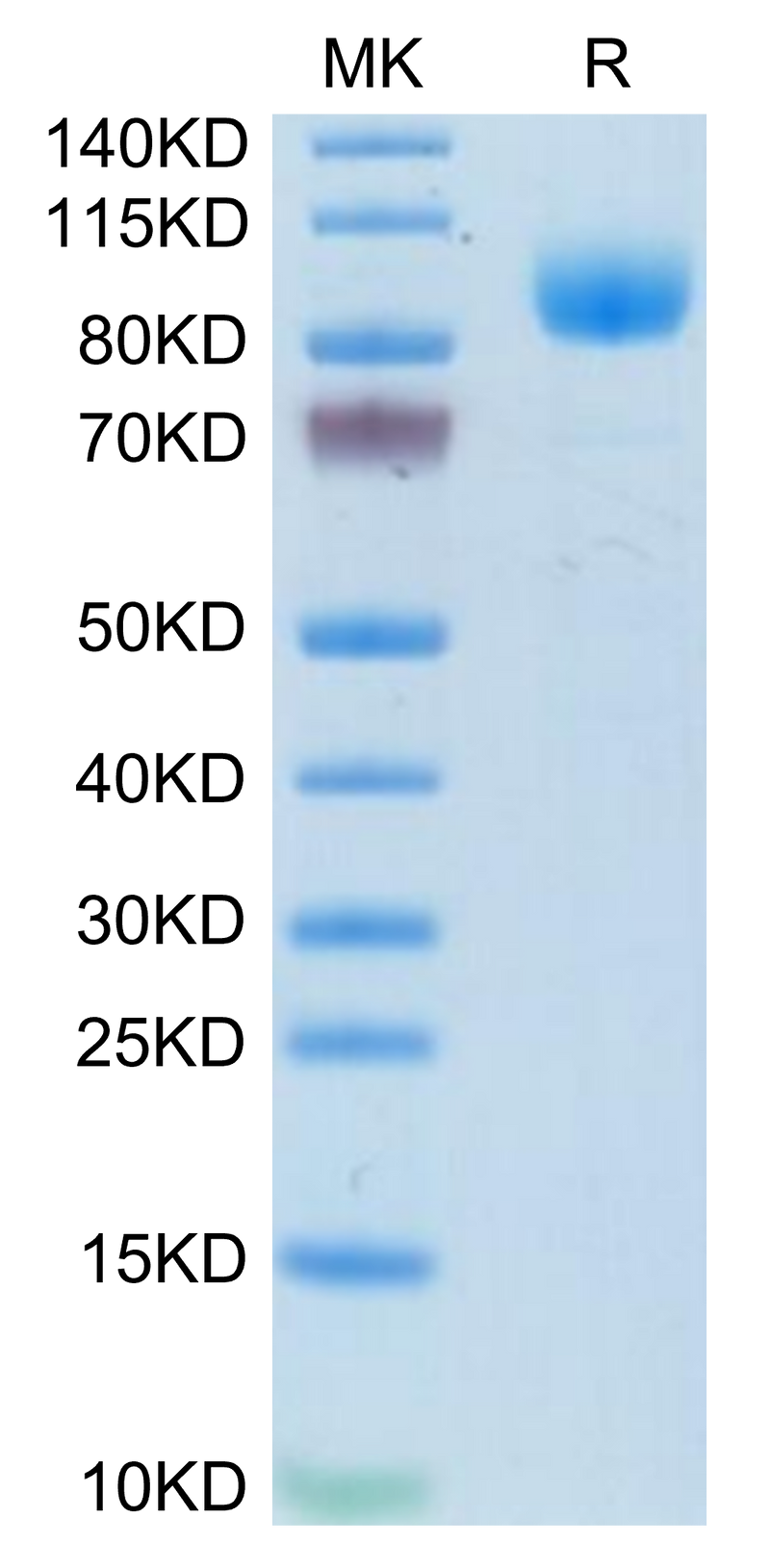 Mouse IFNAR1 on Tris-Bis PAGE under reduced condition. The purity is greater than 95%.Recombinant Mouse IFN alpha/beta R1 Protein, Active