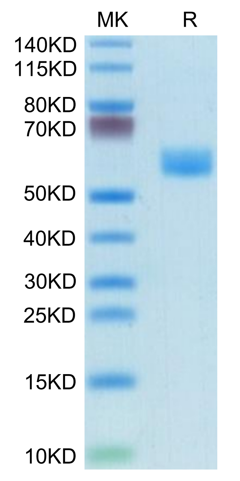 Mouse Fas on Tris-Bis PAGE under reduced condition. The purity is greater than 95%.Recombinant Mouse Fas/TNFRSF6/CD95 Protein, Active