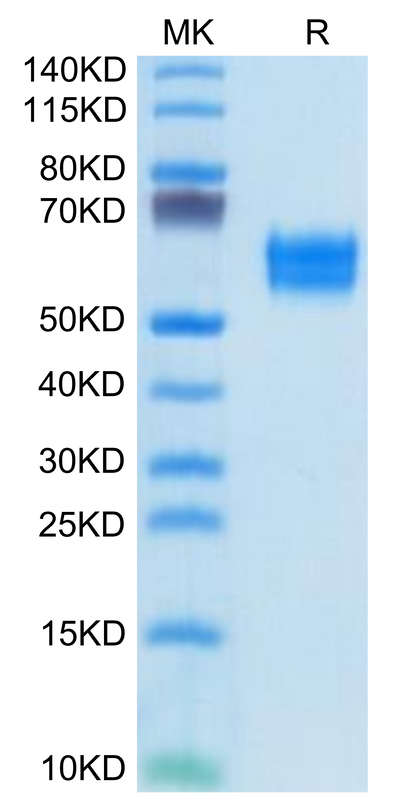 Human IL-1R1 on Tris-Bis PAGE under reduced condition. The purity is greater than 95%.Recombinant Human IL-1R1 Protein, Active