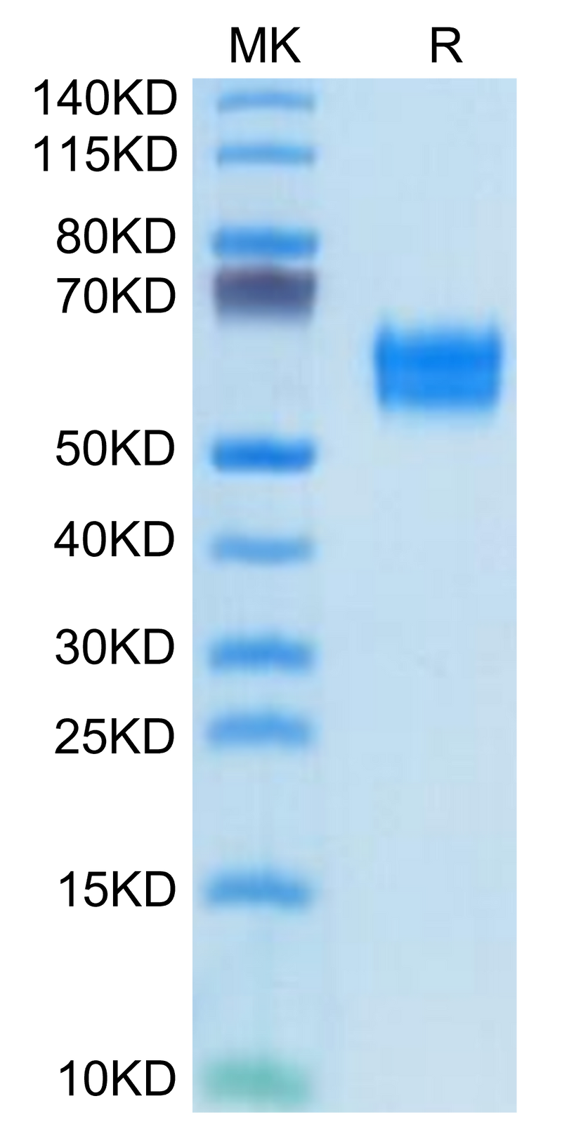 Human IL-1R1 on Tris-Bis PAGE under reduced condition. The purity is greater than 95%.Recombinant Human IL-1R1 Protein, Active