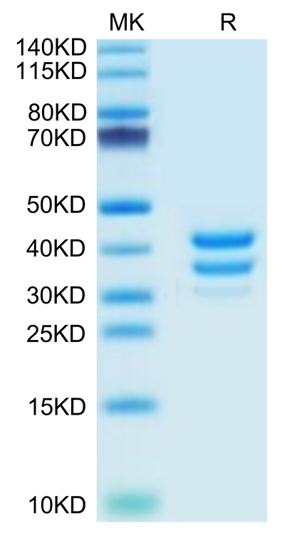 Mouse BAFFR on Tris-Bis PAGE under reduced condition. The purity is greater than 95%.Recombinant Mouse BAFFR/TNFRSF13C Protein, Active
