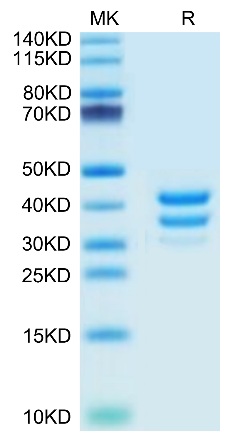 Mouse BAFFR on Tris-Bis PAGE under reduced condition. The purity is greater than 95%.Recombinant Mouse BAFFR/TNFRSF13C Protein, Active