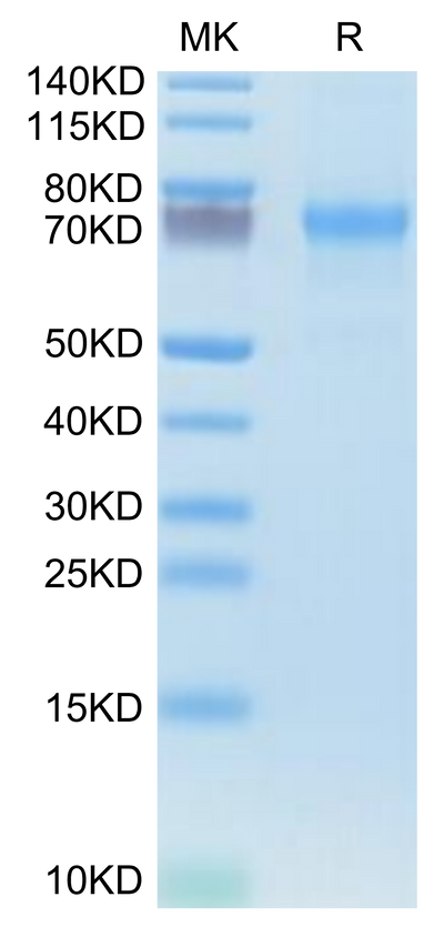 Human CXCL16 on Tris-Bis PAGE under reduced condition. The purity is greater than 95%.Recombinant Human CXCL16 Protein