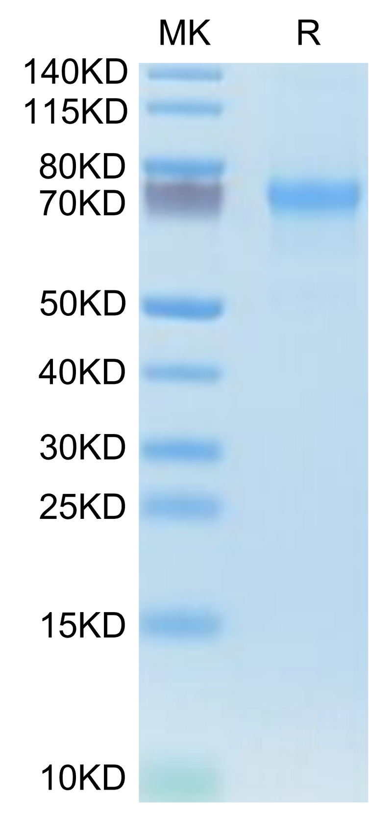 Human CXCL16 on Tris-Bis PAGE under reduced condition. The purity is greater than 95%.Recombinant Human CXCL16 Protein