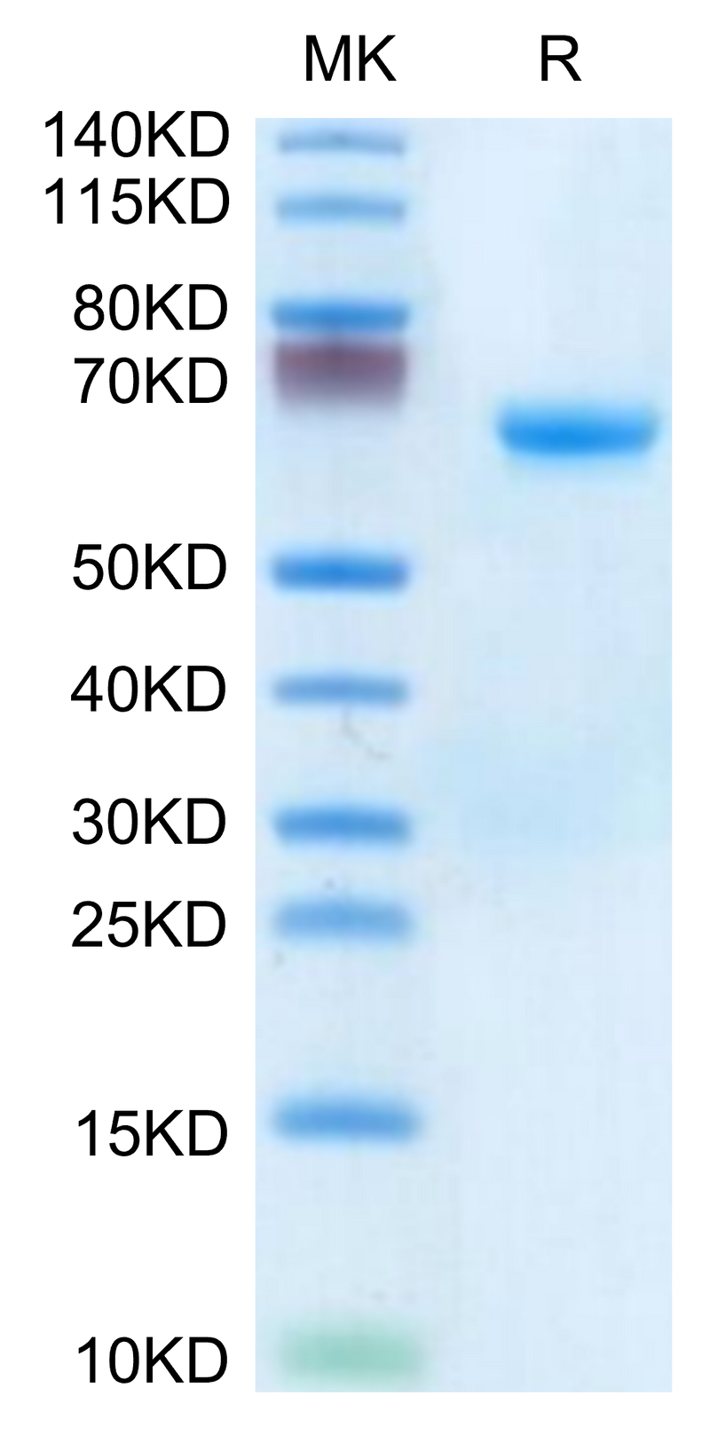 Human CHODL on Tris-Bis PAGE under reduced condition. The purity is greater than 95%.Recombinant Human CHODL Protein
