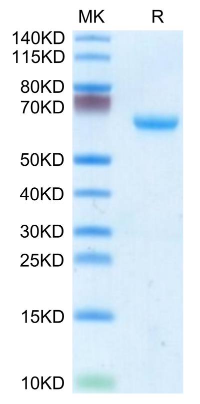 Mouse CHODL on Tris-Bis PAGE under reduced condition. The purity is greater than 95%.Recombinant Mouse CHODL Protein