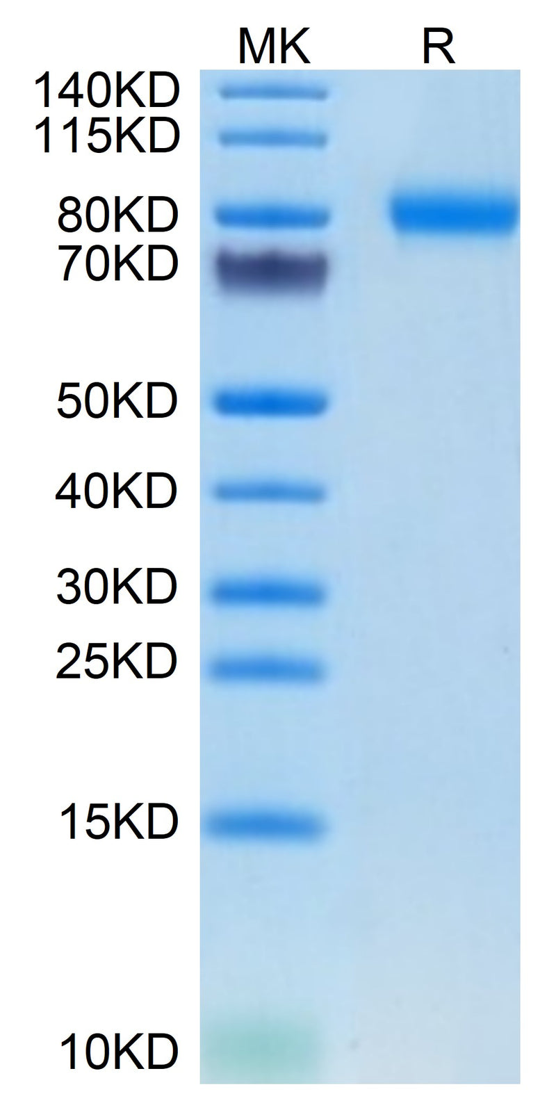 Mouse SEMA4B on Tris-Bis PAGE under reduced condition. The purity is greater than 95%.Recombinant Mouse SEMA4B Protein