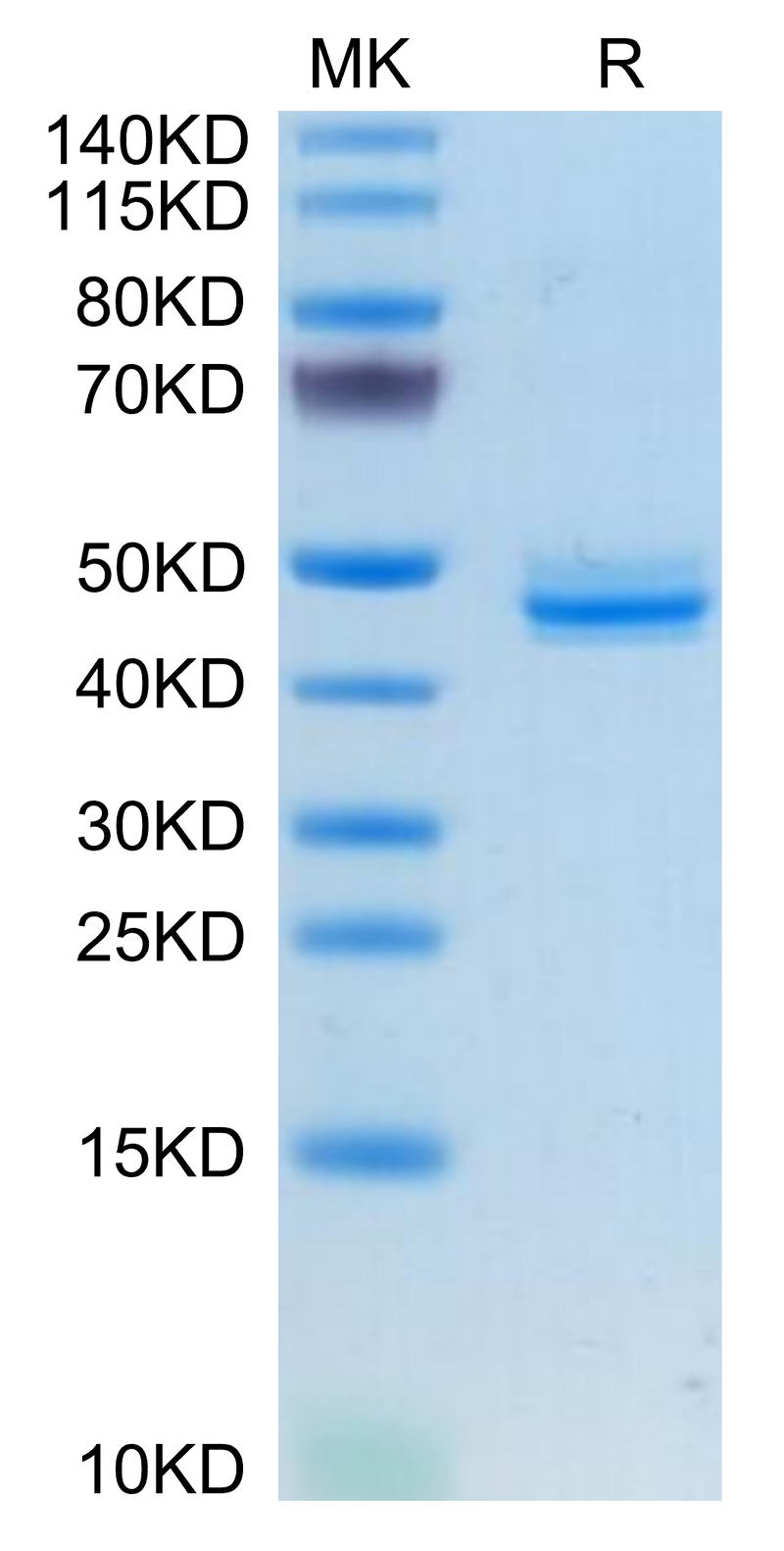 Human CALCA/CGRP on Tris-Bis PAGE under reduced condition. The purity is greater than 95%.Recombinant Human CALCA/CGRP Protein