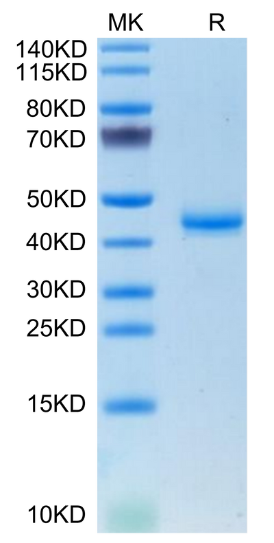Mouse CALCA on Tris-Bis PAGE under reduced condition. The purity is greater than 95%.Recombinant Mouse CALCA/CGRP Protein