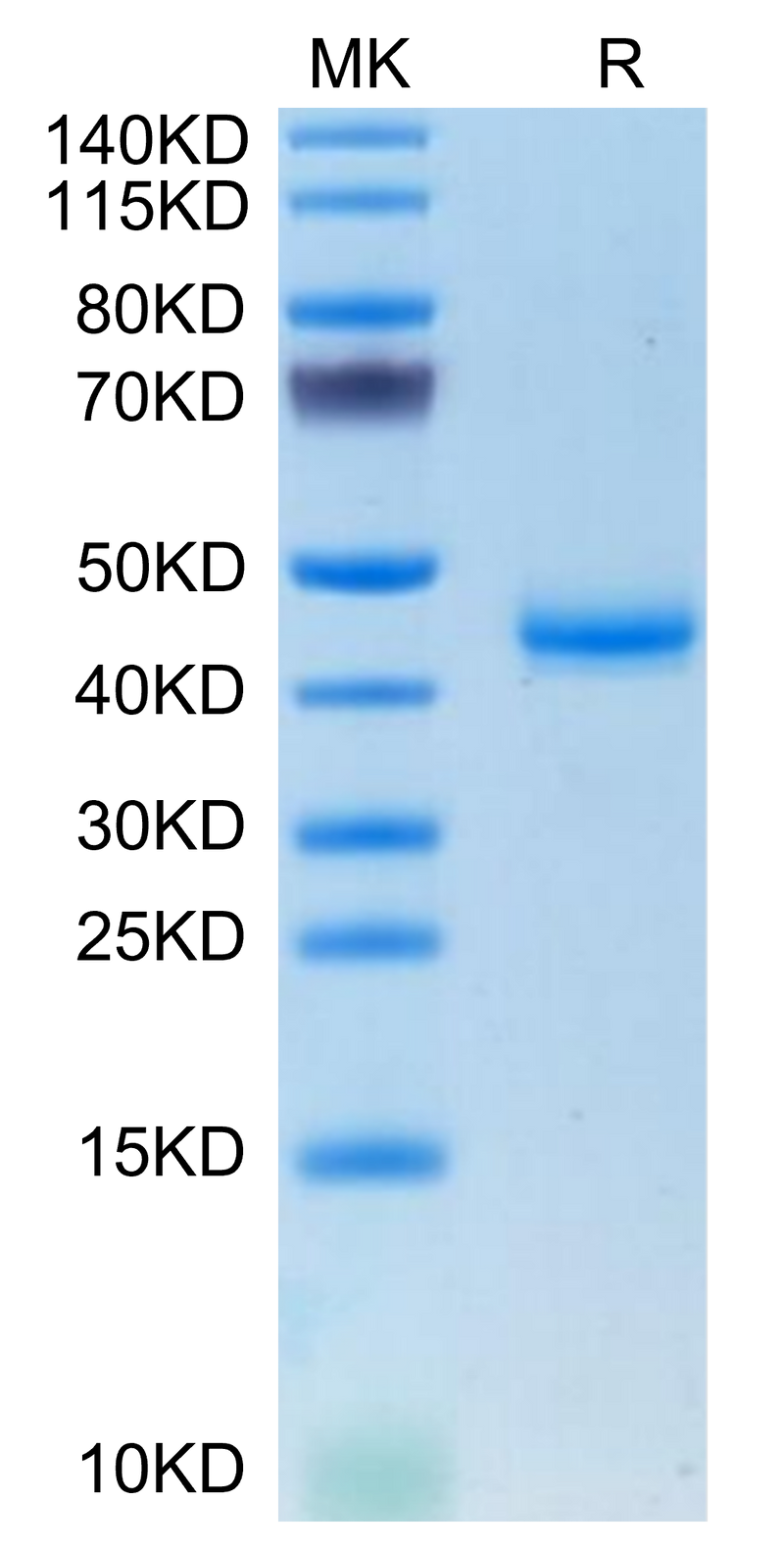 Mouse CALCA on Tris-Bis PAGE under reduced condition. The purity is greater than 95%.Recombinant Mouse CALCA/CGRP Protein