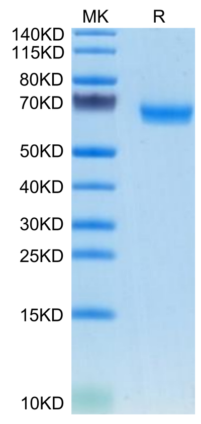 Mouse TMEM106B on Tris-Bis PAGE under reduced condition. The purity is greater than 95%.Recombinant Mouse TMEM106B Protein