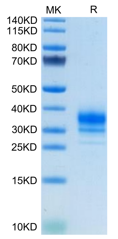 Human FOLR2 on Tris-Bis PAGE under reduced condition. The purity is greater than 95%.Recombinant Human FOLR2 Protein, Active