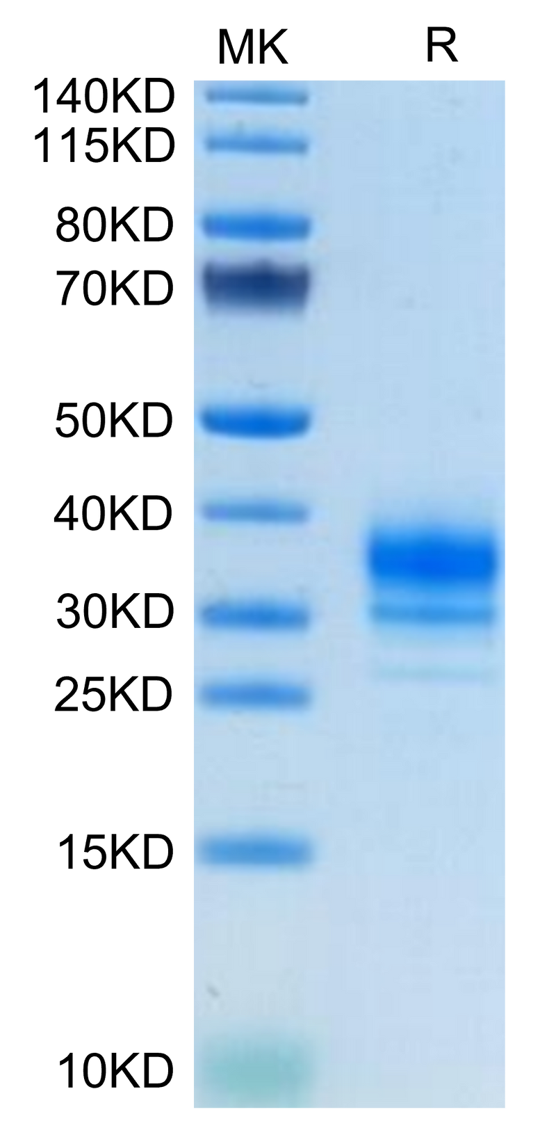 Human FOLR2 on Tris-Bis PAGE under reduced condition. The purity is greater than 95%.Recombinant Human FOLR2 Protein, Active