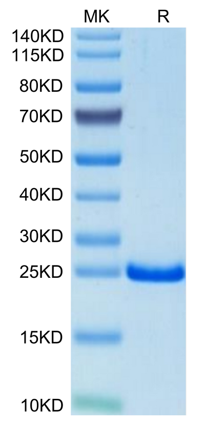 Mouse TIMP-2 on Tris-Bis PAGE under reduced condition. The purity is greater than 95%.Recombinant Mouse TIMP-2 Protein