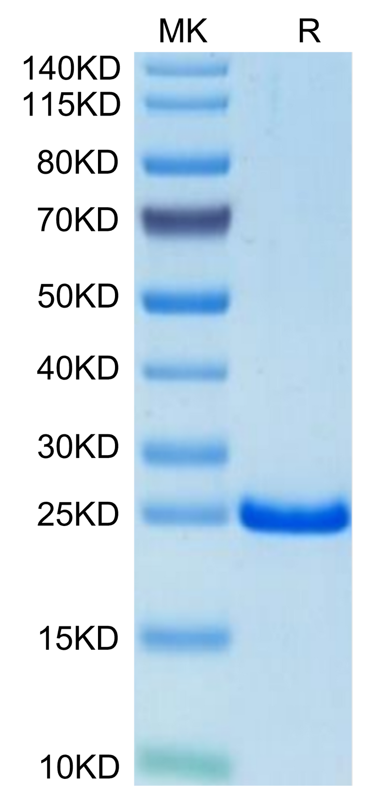 Mouse TIMP-2 on Tris-Bis PAGE under reduced condition. The purity is greater than 95%.Recombinant Mouse TIMP-2 Protein