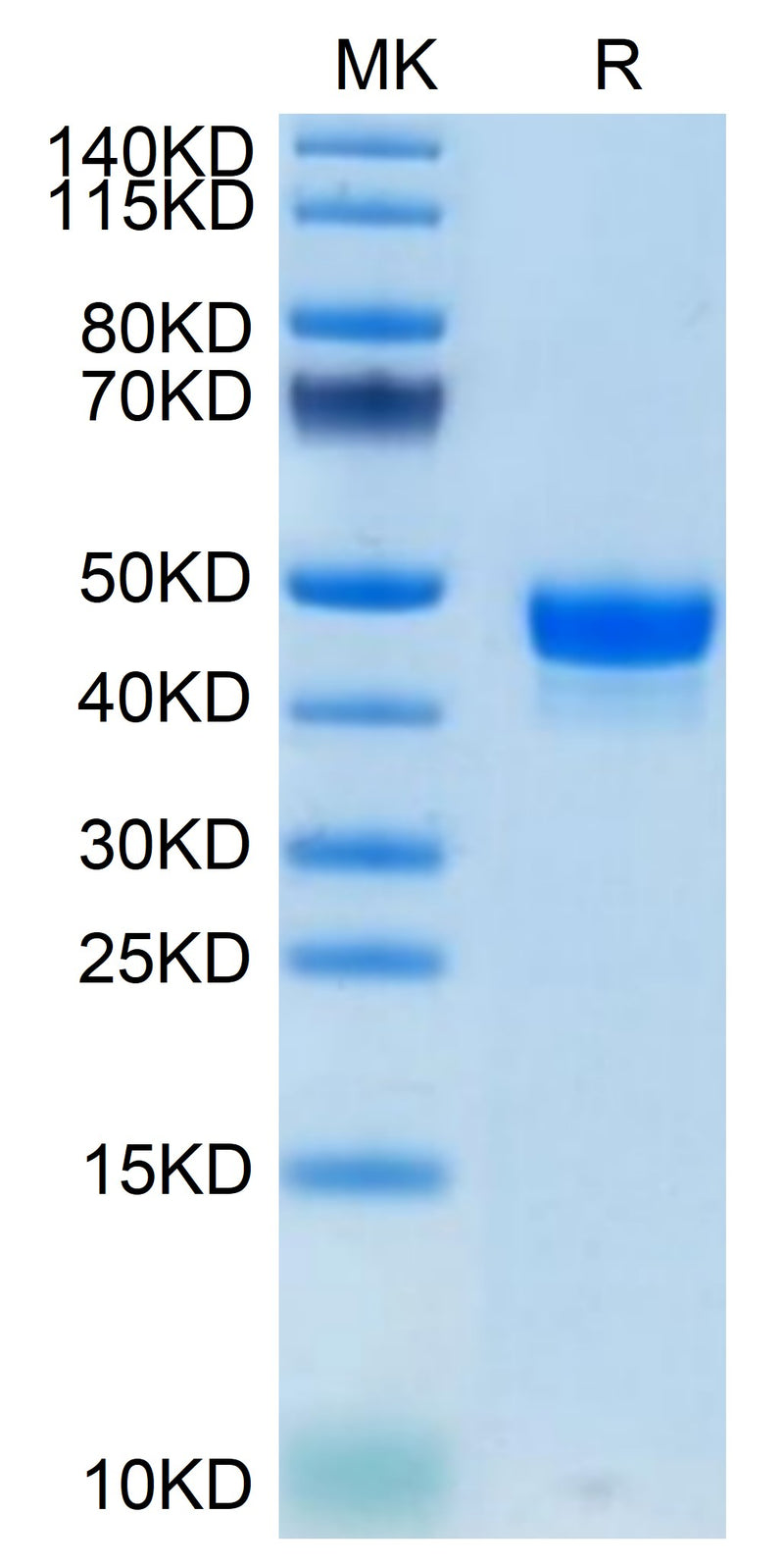 Mouse Nectin-2 on Tris-Bis PAGE under reduced condition. The purity is greater than 95%.Recombinant Mouse Nectin-2/CD112 Protein, Active
