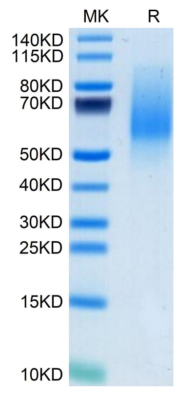 Mouse MANSC1 on Tris-Bis PAGE under reduced condition. The purity is greater than 95%.Recombinant Mouse MANSC1 Protein
