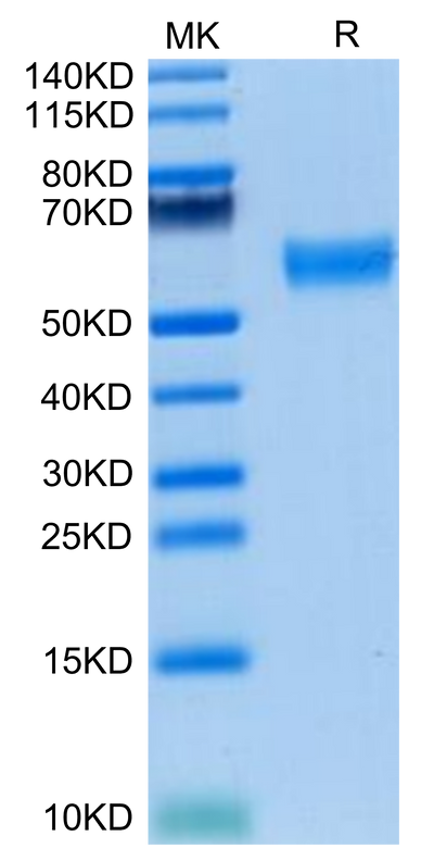 Mouse FLT3 Ligand on Tris-Bis PAGE under reduced condition. The purity is greater than 95%.Recombinant Mouse FLT3 Ligand Protein, Active