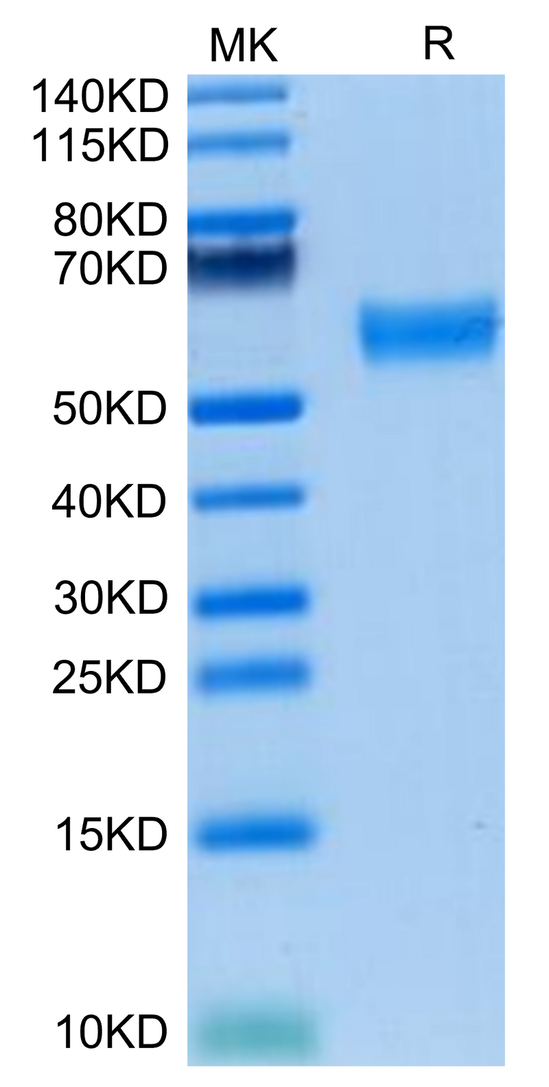 Mouse FLT3 Ligand on Tris-Bis PAGE under reduced condition. The purity is greater than 95%.Recombinant Mouse FLT3 Ligand Protein, Active