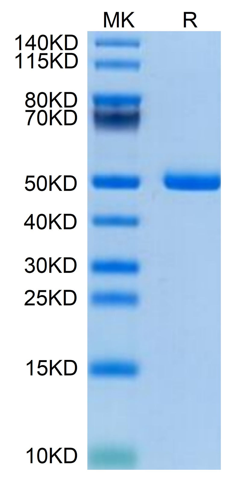 Mouse PSMP on Tris-Bis PAGE under reduced condition. The purity is greater than 95%.Recombinant Mouse PSMP Protein