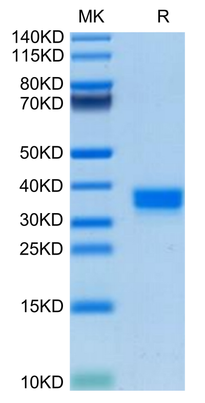 Mouse FOLR2 on Tris-Bis PAGE under reduced condition. The purity is greater than 95%.Recombinant Mouse FOLR2 Protein