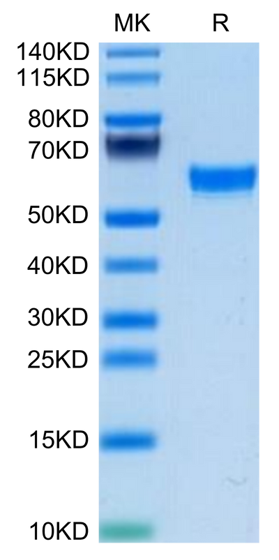 Mouse TNFSF15 on Tris-Bis PAGE under reduced condition. The purity is greater than 95%.Recombinant Mouse TNFSF15 Protein, Active