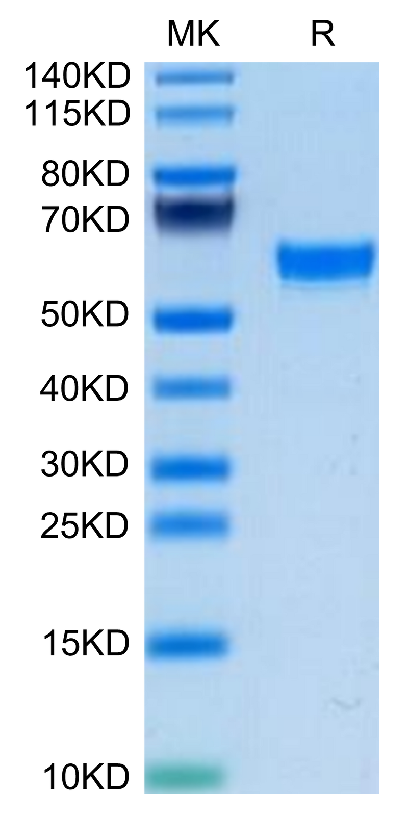 Mouse TNFSF15 on Tris-Bis PAGE under reduced condition. The purity is greater than 95%.Recombinant Mouse TNFSF15 Protein, Active