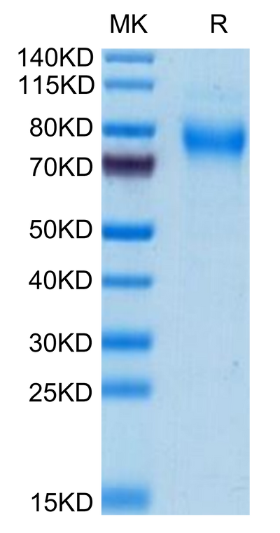 Mouse TREML2/TLT-2 on Tris-Bis PAGE under reduced condition. The purity is greater than 95%.Recombinant Mouse TREML2/TLT-2 Protein