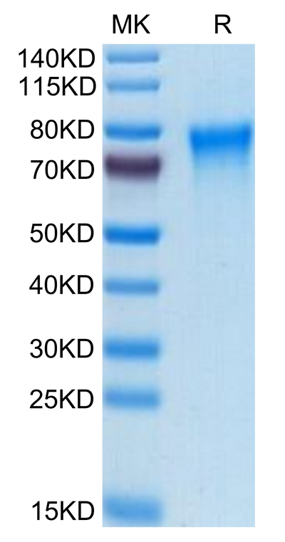 Human TREML2/TLT-2 on Tris-Bis PAGE under reduced condition. The purity is greater than 95%.Recombinant Human TREML2/TLT-2 Protein
