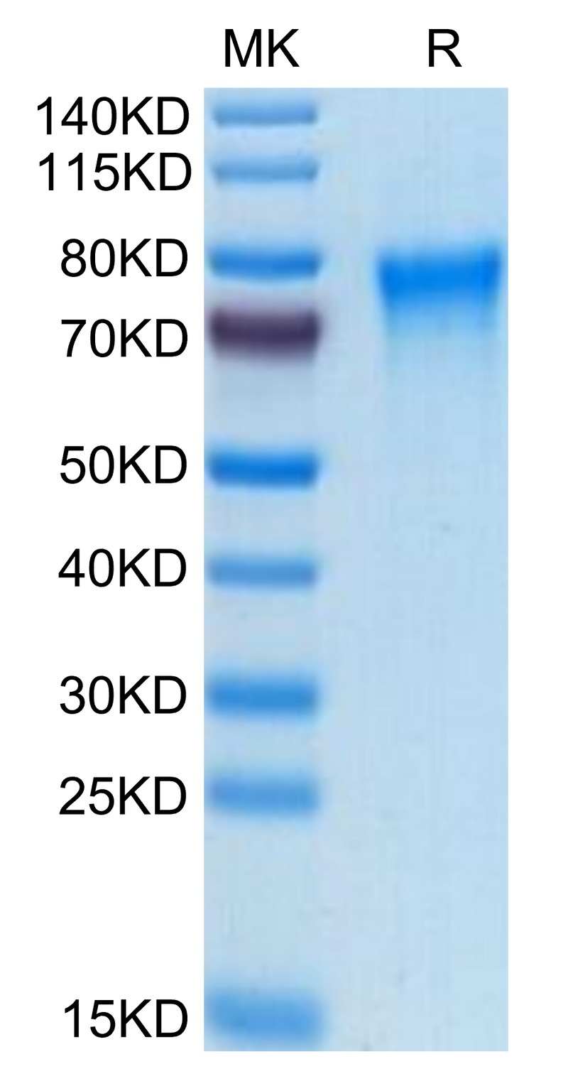 Human TREML2/TLT-2 on Tris-Bis PAGE under reduced condition. The purity is greater than 95%.Recombinant Human TREML2/TLT-2 Protein