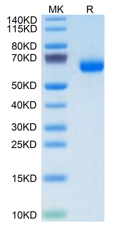 Human PILRA on Tris-Bis PAGE under reduced condition. The purity is greater than 95%.Recombinant Human PILRA Protein