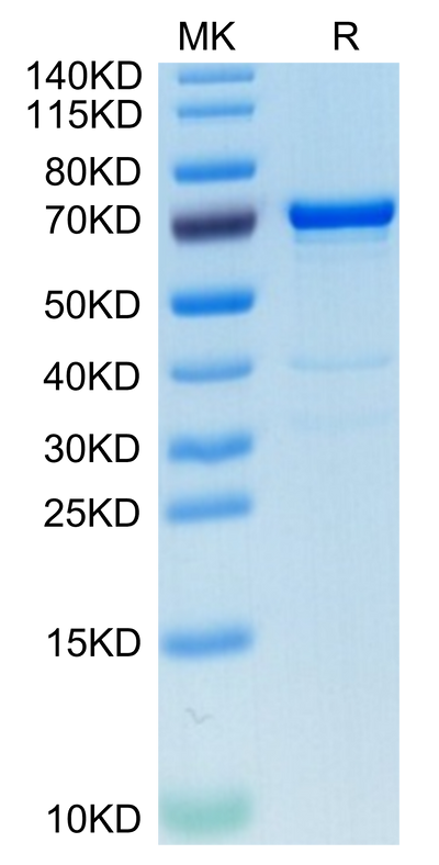 Human AFP on Tris-Bis PAGE under reduced condition. The purity is greater than 95%.Recombinant Human AFP Protein