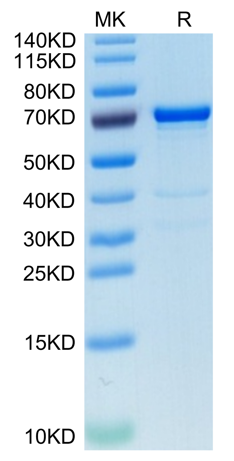 Human AFP on Tris-Bis PAGE under reduced condition. The purity is greater than 95%.Recombinant Human AFP Protein