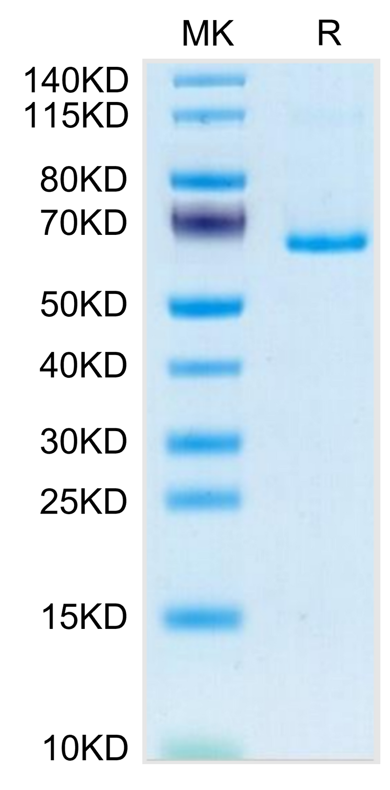 Mouse EphB3 on Tris-Bis PAGE under reduced condition. The purity is greater than 95%.Recombinant Mouse EphB3 Protein