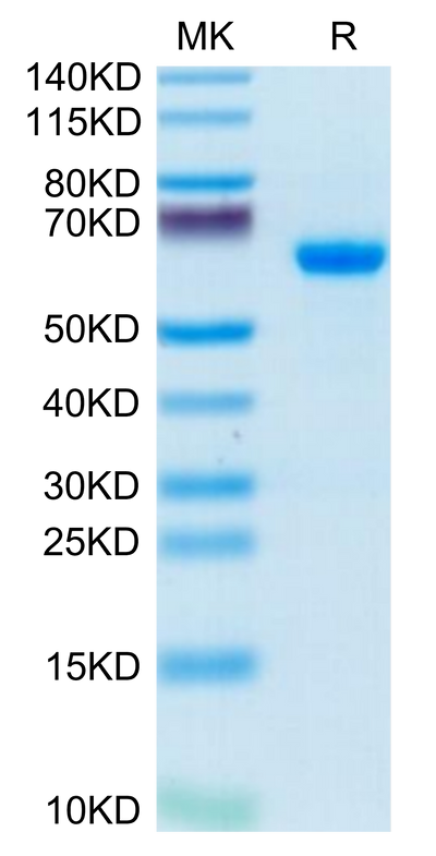Human ADAM8 on Tris-Bis PAGE under reduced condition. The purity is greater than 95%.Recombinant Human ADAM8 Protein, Active
