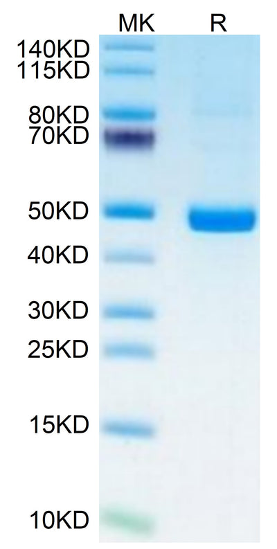 Human PSMP on Tris-Bis PAGE under reduced condition. The purity is greater than 95%.Recombinant Human PSMP Protein