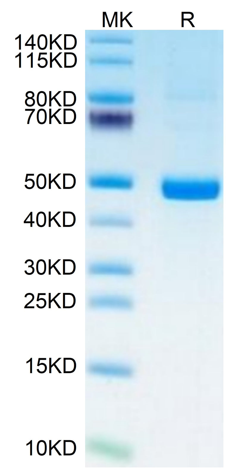 Human PSMP on Tris-Bis PAGE under reduced condition. The purity is greater than 95%.Recombinant Human PSMP Protein