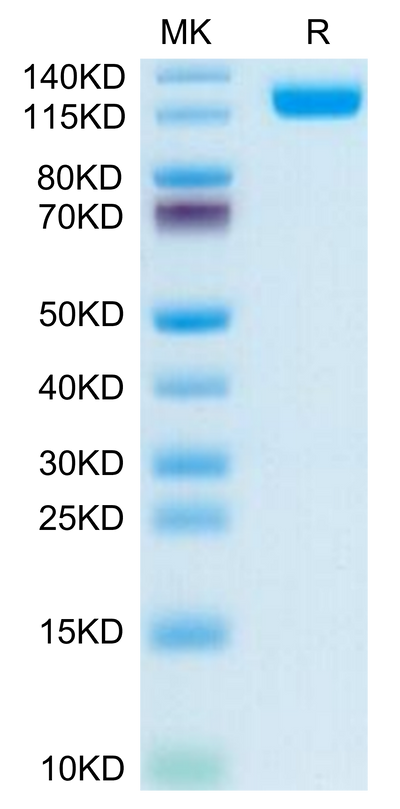 Human CD13/ANPEP on Tris-Bis PAGE under reduced condition. The purity is greater than 95%.Recombinant Human CD13/ANPEP Protein