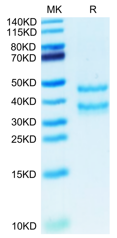 Mouse PK-1/PROK1 on Tris-Bis PAGE under reduced condition. The purity is greater than 95%.Recombinant Mouse PK-1/PROK1 Protein