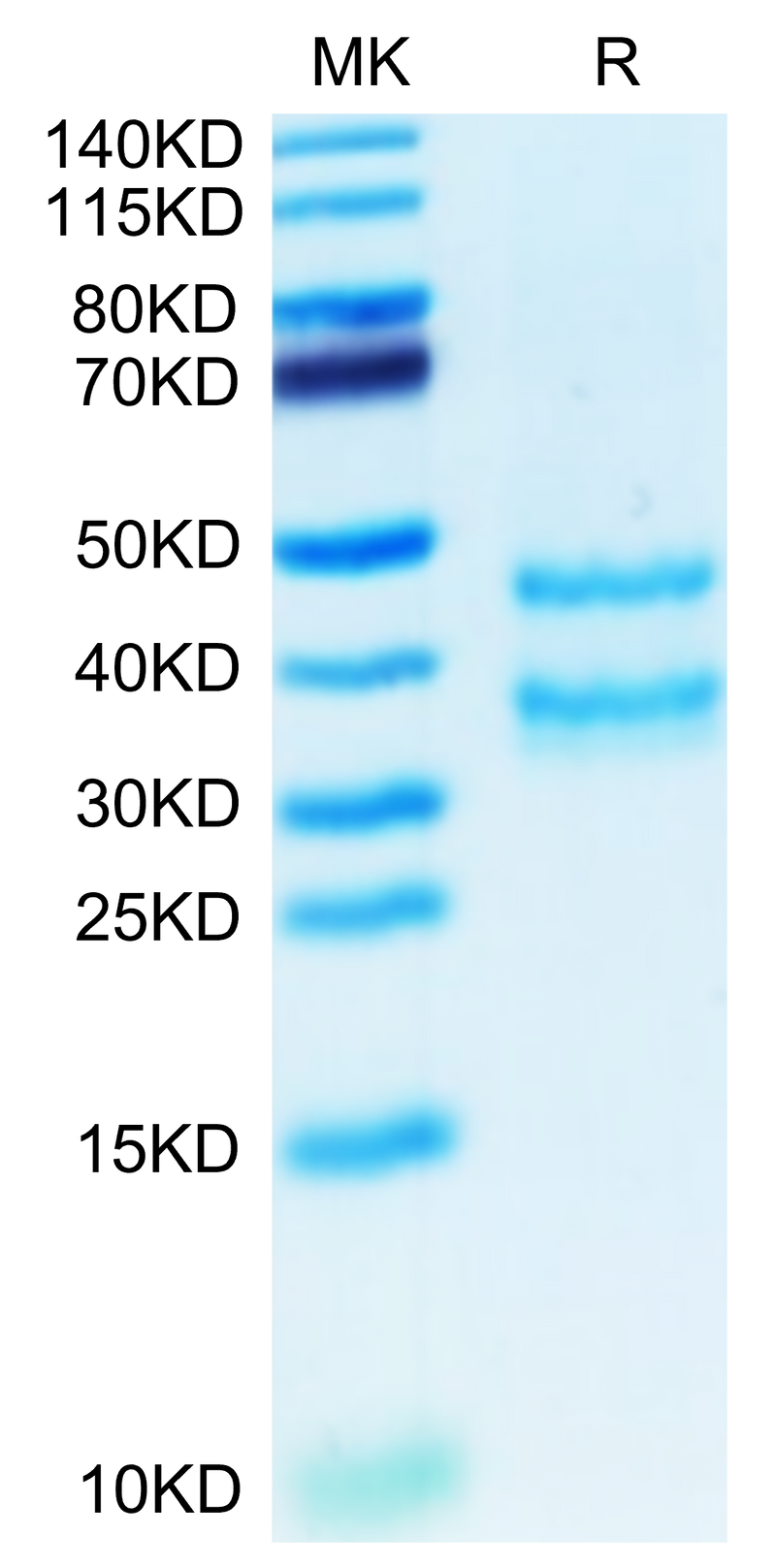 Mouse PK-1/PROK1 on Tris-Bis PAGE under reduced condition. The purity is greater than 95%.Recombinant Mouse PK-1/PROK1 Protein