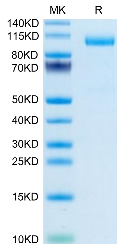 Mouse Thyroid Peroxidase on Tris-Bis PAGE under reduced condition. The purity is greater than 95%.Recombinant Mouse Thyroid Peroxidase Protein