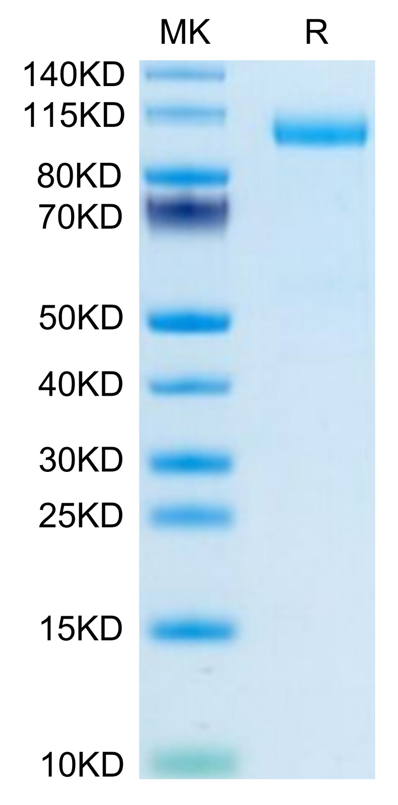 Mouse Thyroid Peroxidase on Tris-Bis PAGE under reduced condition. The purity is greater than 95%.Recombinant Mouse Thyroid Peroxidase Protein